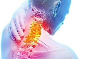 Symptoms of cervical osteocondrosis and nutritional rules for disease